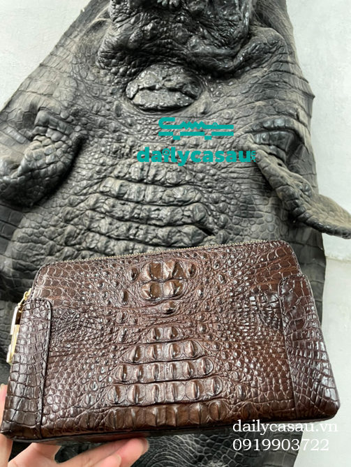 Da ngoại lai - Điều bạn nên biết